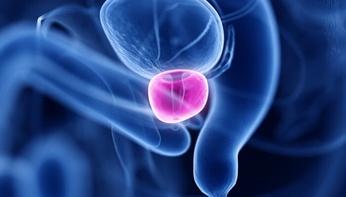 Plus de 110 millions d’hommes dans le monde seraient concernés par une hypertrophie bénigne de la prostate de la prostate.
